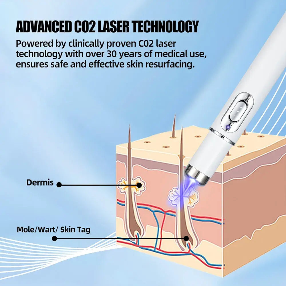 Mole And Wart Removal Pen Non Invasive Mole And Wart Removal