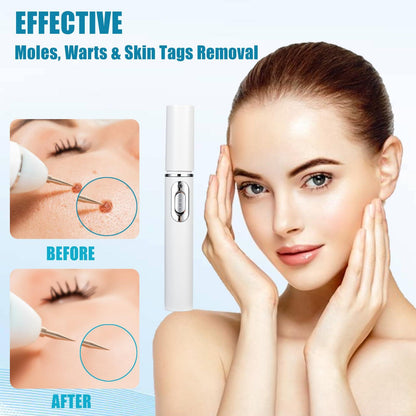 Mole And Wart Removal Pen Non Invasive Mole And Wart Removal