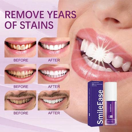 Hismile V34 Purple Whitening Toothpaste Remove Stains