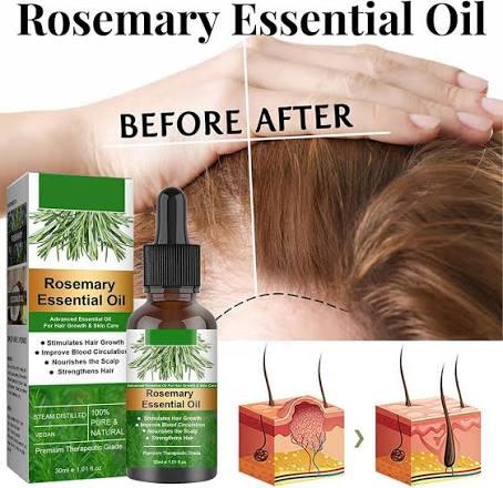 Rosemary Essential Oil for Hair Growth – Pure & Natural