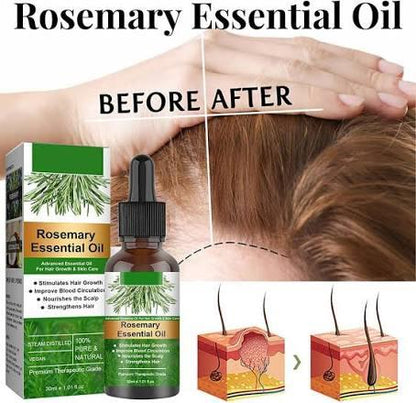 Rosemary Essential Oil for Hair Growth – Pure & Natural
